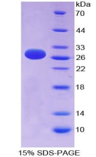 Human CD135 / FLT3 Protein (Recombinant His-T7)