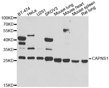 Polyclonal Rabbit anti-Human CAPNS1 / CAPN4 Antibody (IHC, WB)