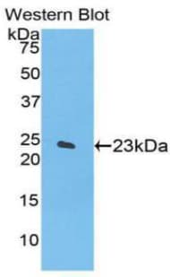 SPTAN1 / Alpha Fodrin Antibody (aa1950-2137, APC)