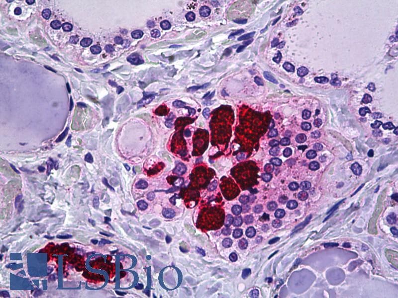 IHC-plus™ Polyclonal Rabbit anti-Human CIB2 / KIP2 Antibody (aa21-70, IHC)