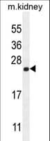 CALML4 Antibody (aa167-196)
