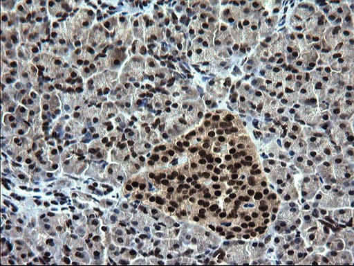 RPRD1B Antibody (clone OTI1C9)