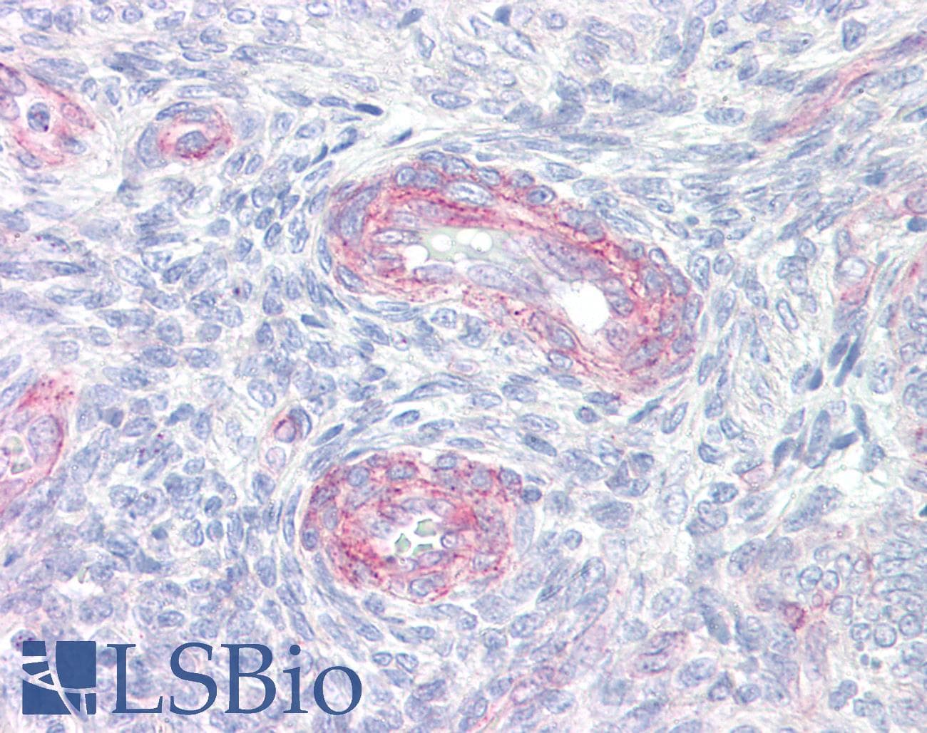 IHC-plus™ Polyclonal Rabbit anti-Human PLA2G4A Antibody (aa471-520, IHC, IF, WB)