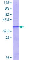 Human CLC Protein (Recombinant GST, N-terminus)