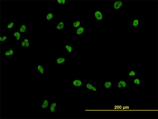 Monoclonal Mouse anti-Human USF2 Antibody (clone 5E9, IHC, IF, WB)