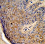 Polyclonal Rabbit anti-Human TCHP Antibody (aa291-320, IHC, WB)