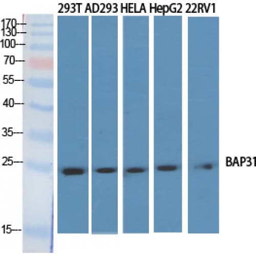 BCAP31 / BAP31 Antibody (120-200 aa, Internal)