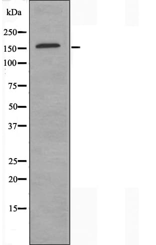 SMARCC2 Antibody