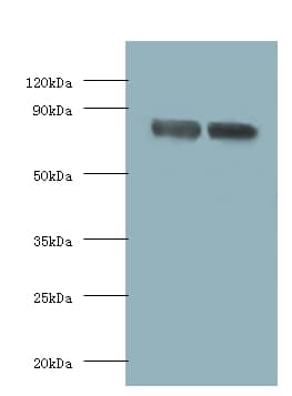 FOLH1 / PSMA Antibody (HRP)