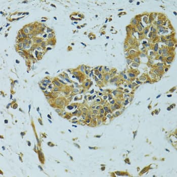 Polyclonal Rabbit anti-Human HSPB1 / HSP27 Antibody (IHC, IF, WB)