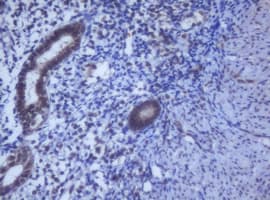 Monoclonal Mouse anti-Human DDX59 Antibody (clone OTI2G1, IHC, WB)