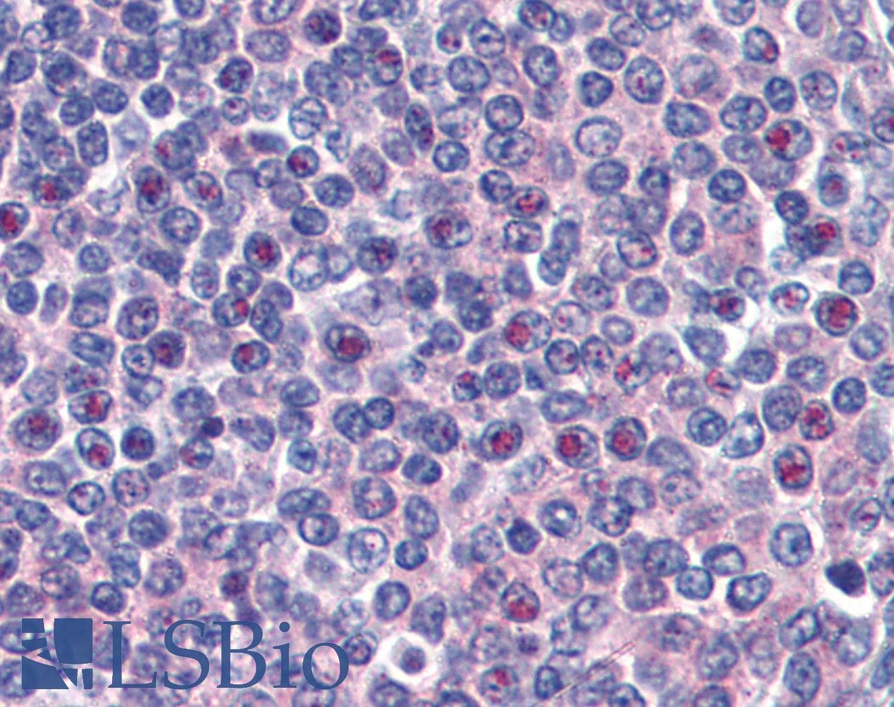 IHC-plus™ Monoclonal Mouse anti-Human CENPF / CENP-F Antibody (clone 14C10 1D8, aa1759-2093, IHC, IF, WB)
