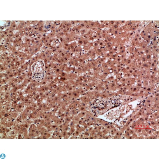 Polyclonal Rabbit anti-Human NOX1 Antibody (IHC, WB)