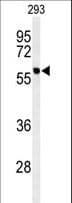 Polyclonal Rabbit anti-Human PPM1G Antibody (aa150-180, WB)