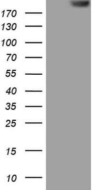 TG / Thyroglobulin Antibody (aa20-358, clone OTI2B5)