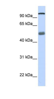 Polyclonal Rabbit anti-Human DHX32 Antibody (N-Terminus, WB)