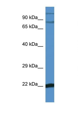 NFKBIZ / IKBZ Antibody (C-Terminus)