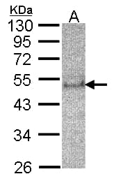 SOCS4 Antibody (aa376-440)