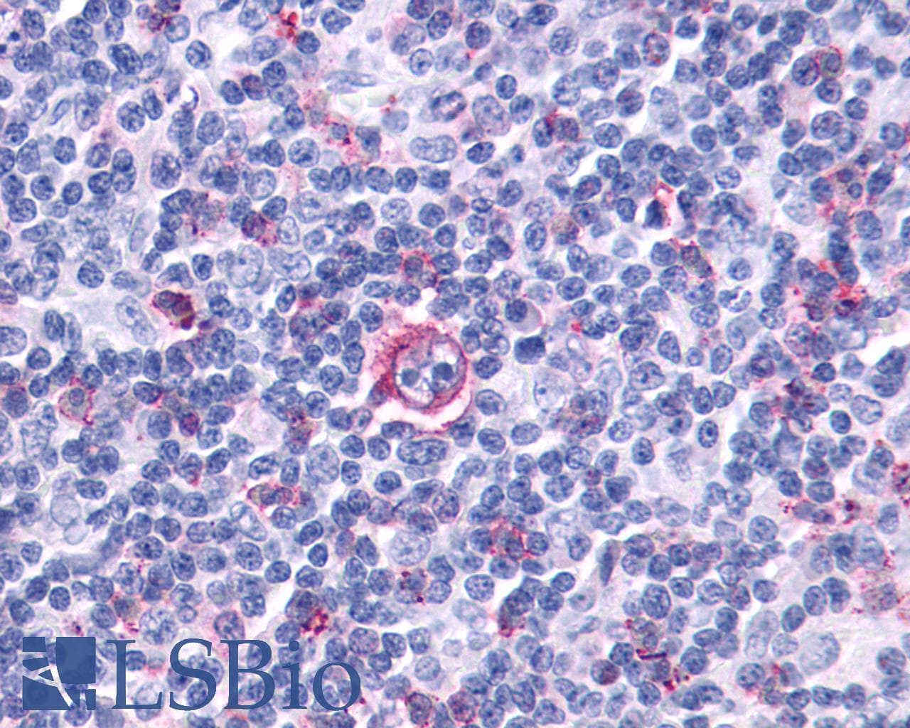 PathPlus™ Polyclonal Rabbit anti-Human LTB4R2 / BLT2 Antibody (C-Terminus, IHC)