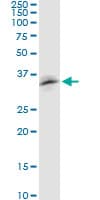 RNF126 Antibody (clone 3F11)