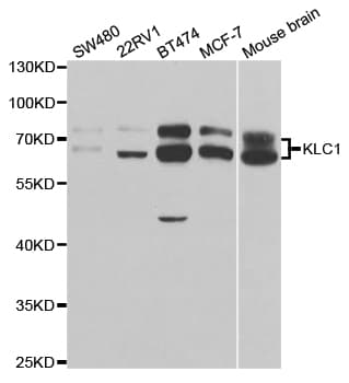 Polyclonal Rabbit anti-Human KLC1 / Kinesin Light Chain 1 Antibody (IHC, IF, WB)