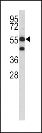 Polyclonal Rabbit anti-Human HMGCS1 / HMG-CoA Synthase 1 Antibody (aa442-470, IHC, WB)