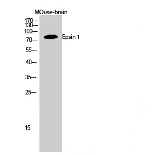 Polyclonal Rabbit anti-Human Epsin 1 / EPN1 Antibody (140-220 aa, Internal, WB)