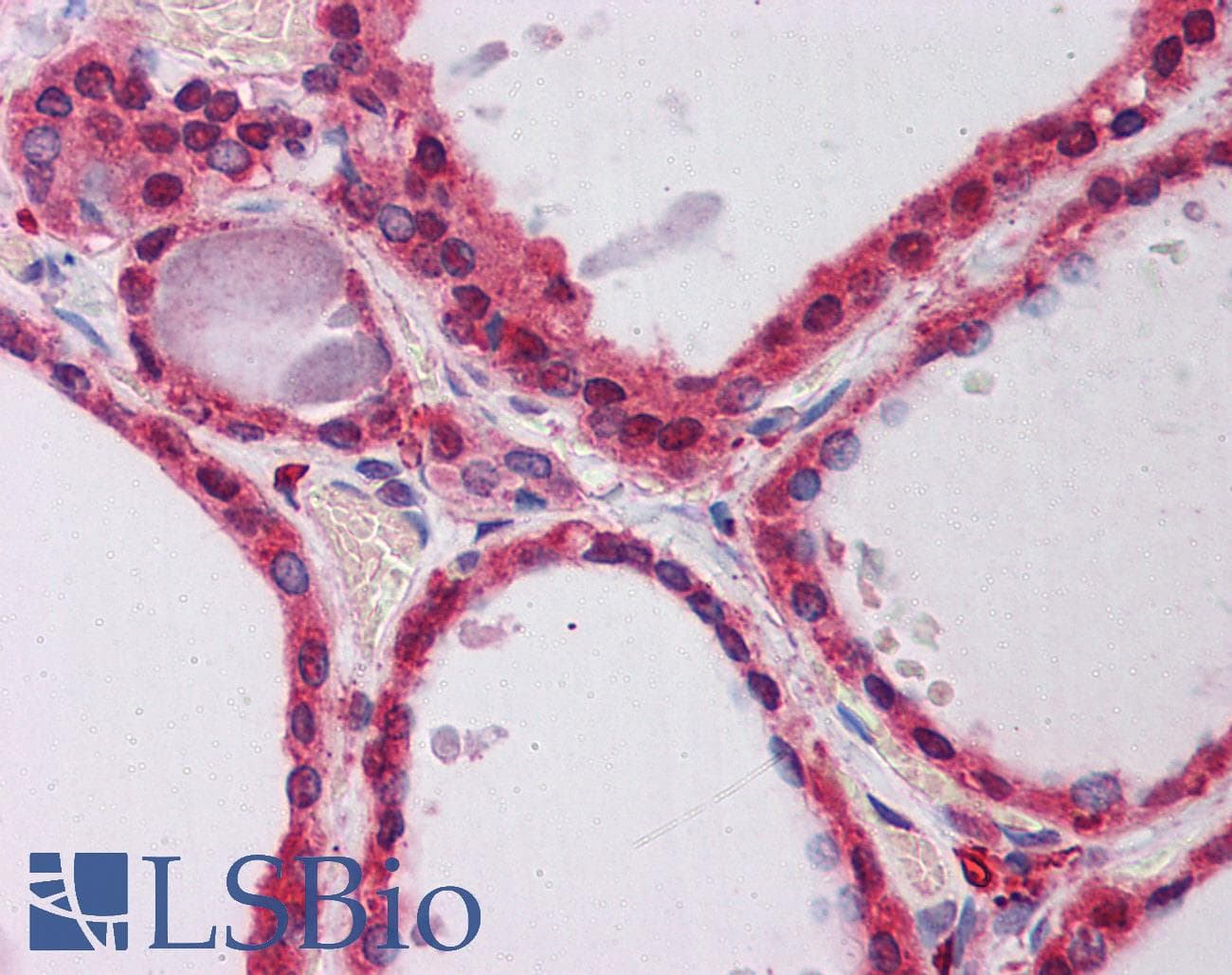 PPP2R1A Antibody (aa107-156)