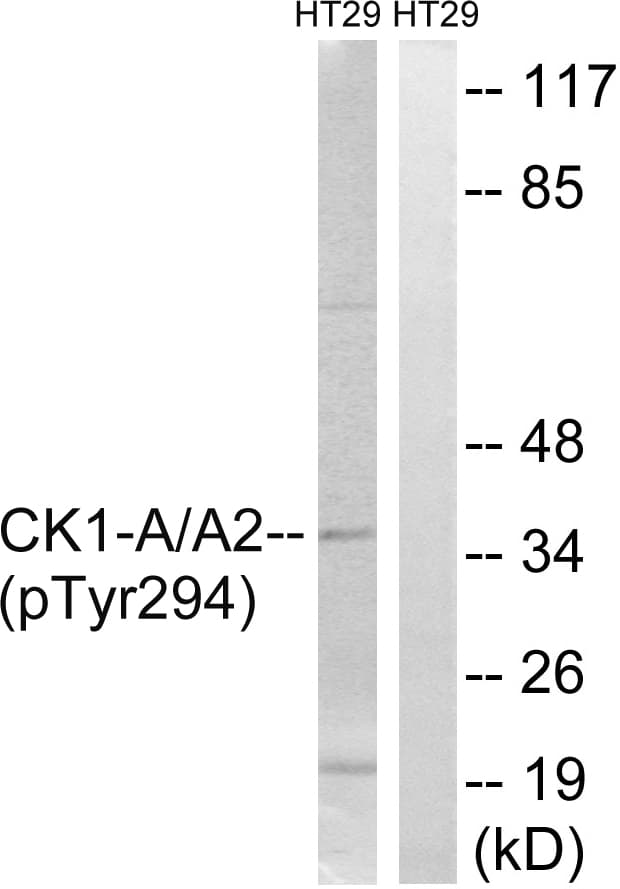 CSNK1A1 / CK1 Alpha Antibody (phospho-Tyr294)
