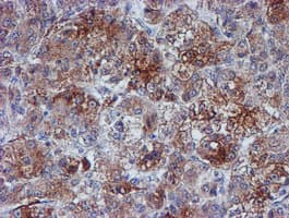 VCAM1 / CD106 Antibody (clone OTI4E8)