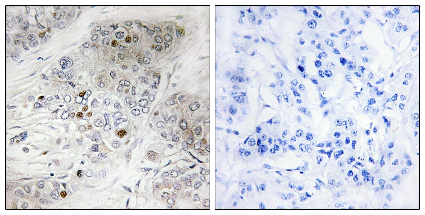 TP53 / p53 Antibody (phospho-Ser9)