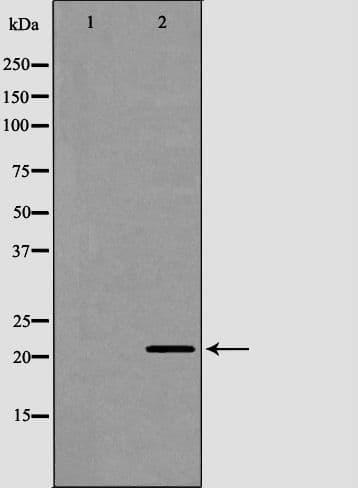 CRH / CRF Antibody