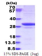 Human GARS / Glycyl tRNA Synthetase Protein (Recombinant His)