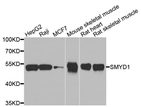 SMYD1 Antibody