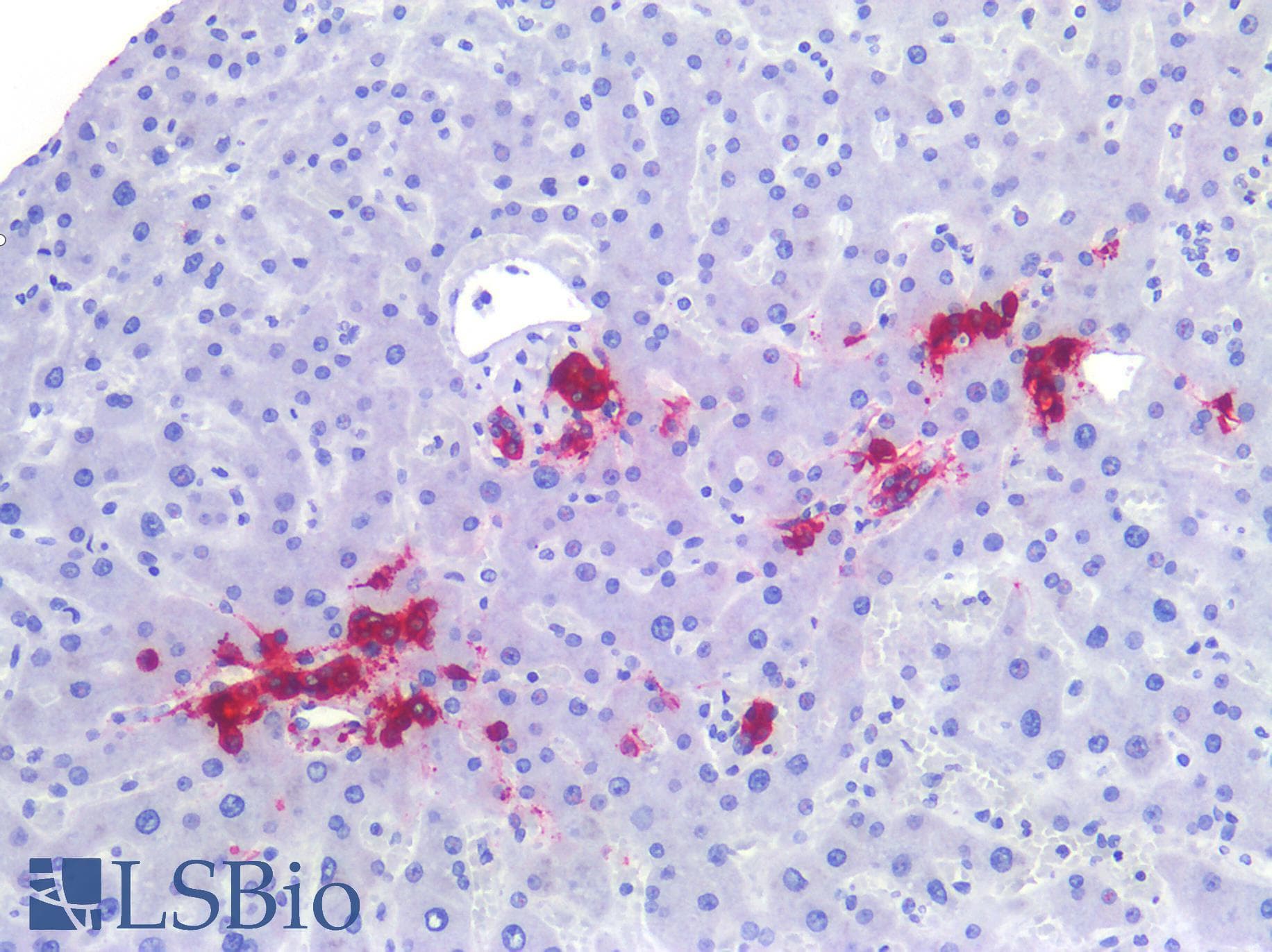 PathPlus™ Monoclonal Mouse anti-Human Sialylated Lewis a / CA 19-9 Antibody (IHC)