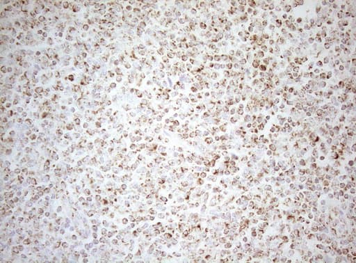 DECR1 Antibody (clone OTI8F11)