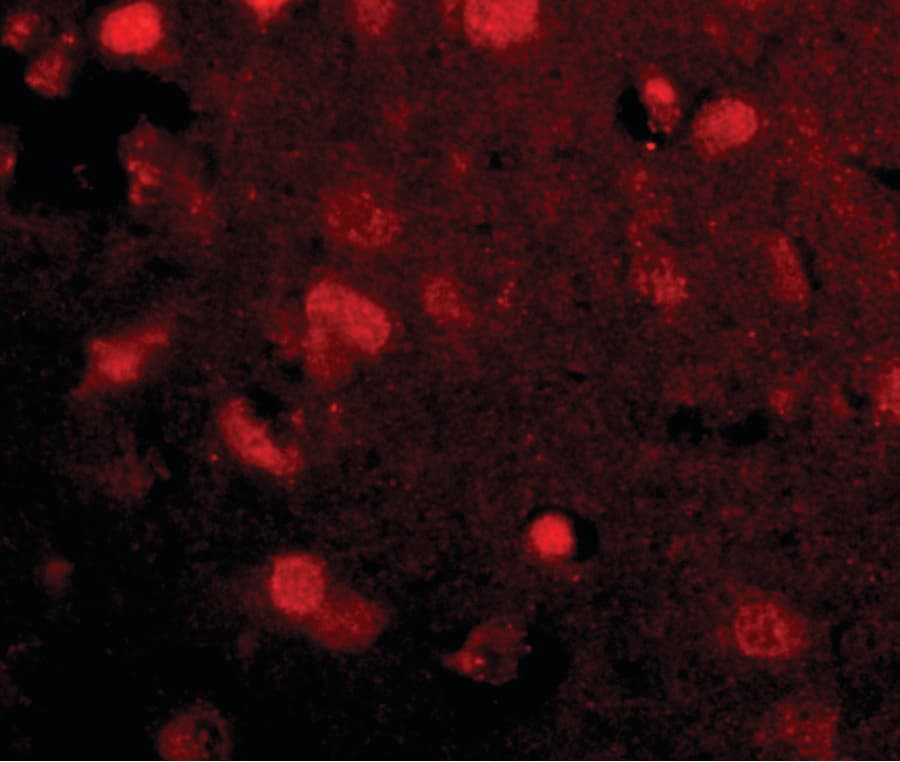 IHC-plus™ SLITRK4 Antibody