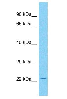 CDV3 Antibody (aa88-137)
