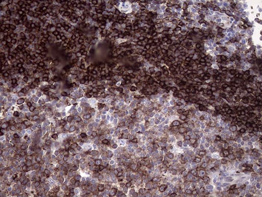 RAB23 Antibody (aa1-234, clone OTI2A8)