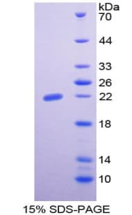 Rat EPO / Erythropoietin Protein (Recombinant His-T7)