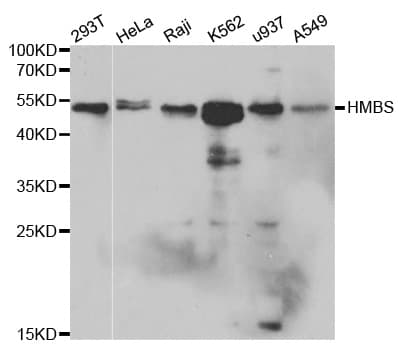 HMBS / PBGD Antibody