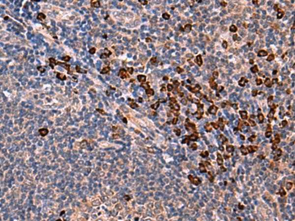 IA-6 / INSM2 Antibody