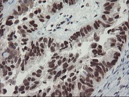 Monoclonal Mouse anti-Human TPRKB Antibody (clone OTI1E9, IHC, WB)