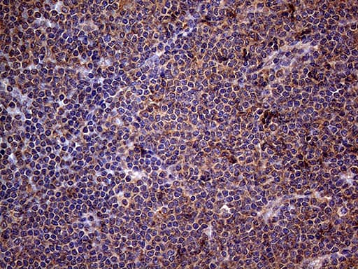 Monoclonal Mouse anti-Human CSF2 / GM-CSF Antibody (clone OTI10G3, aa18-144, IHC, WB)