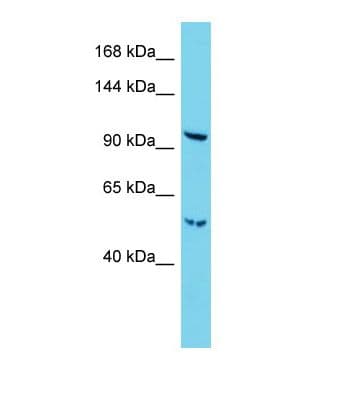Radil Antibody (aa618-667)