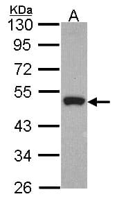 PathPlus™ Polyclonal Rabbit anti-Human Peripherin Antibody (Internal, IHC, WB)