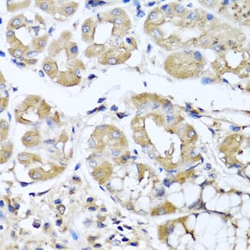 IFNL1 / IL29 Antibody
