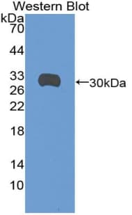 SDC1 / Syndecan 1 / CD138 Antibody (aa47-305, PE)
