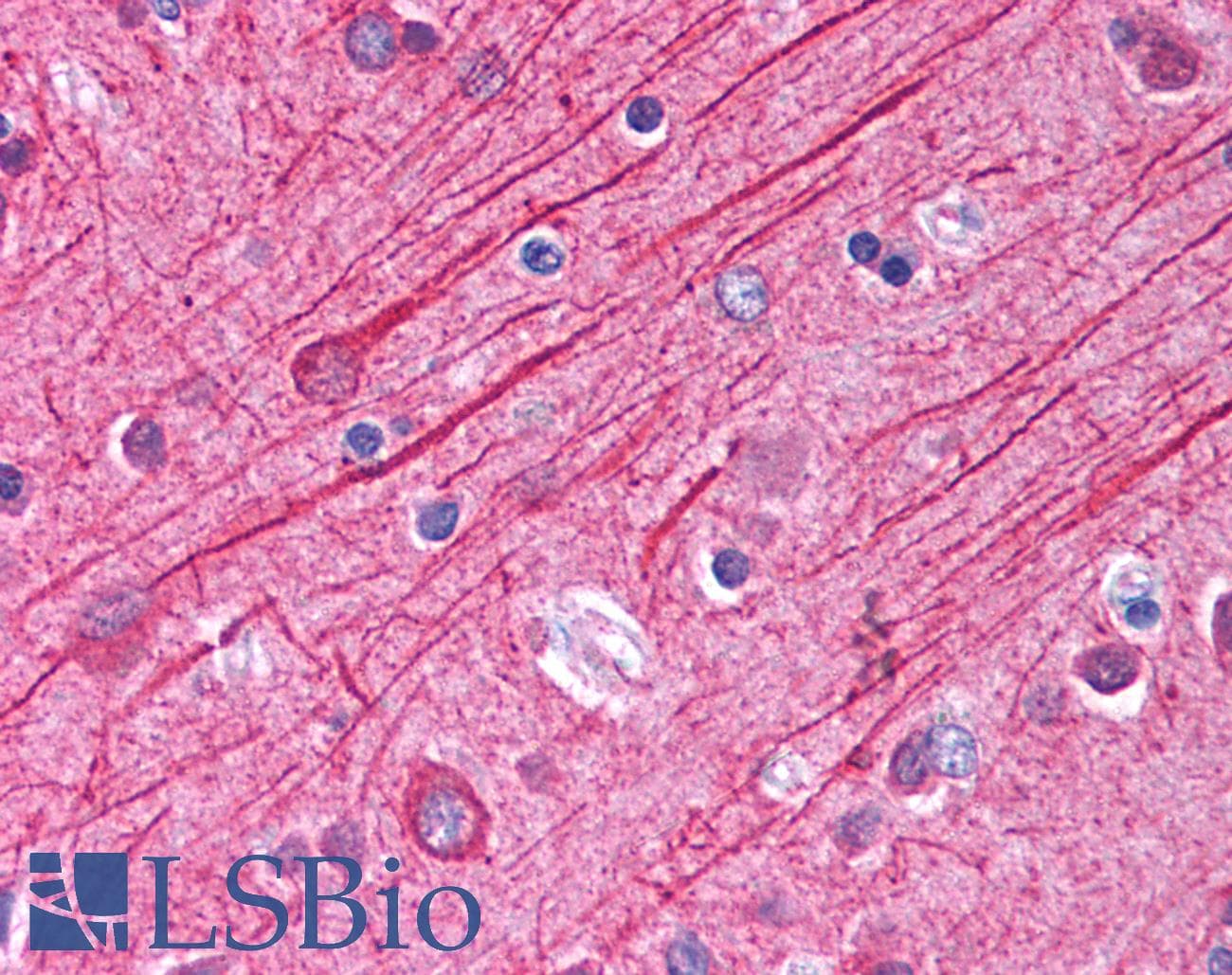 IHC-plus™ Polyclonal Rabbit anti-Human Alpha Tubulin Antibody (aa425-451, IHC, IF, WB)