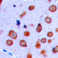 GRIN1 / NMDAR1 Antibody (C-Terminus)